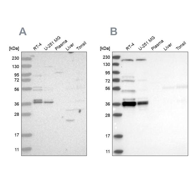 C1orf131 Antibody in Western Blot (WB)