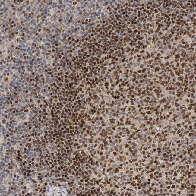 HENMT1 Antibody in Immunohistochemistry (IHC)