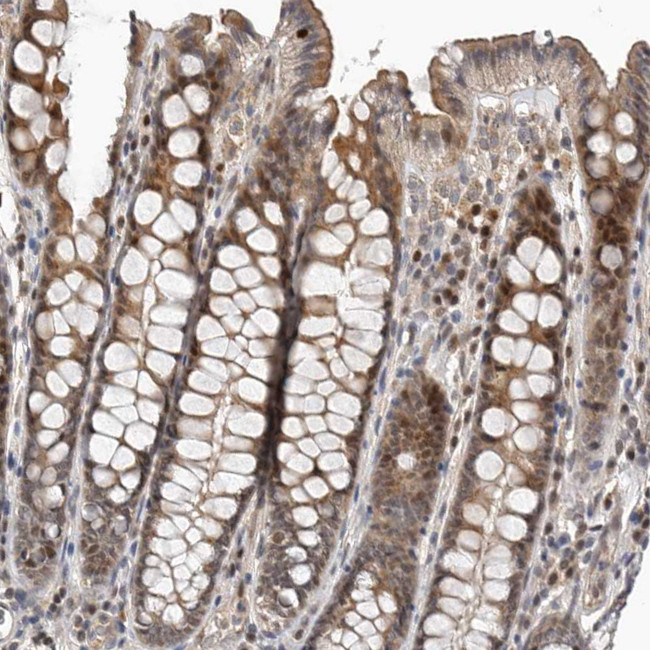 HENMT1 Antibody in Immunohistochemistry (IHC)