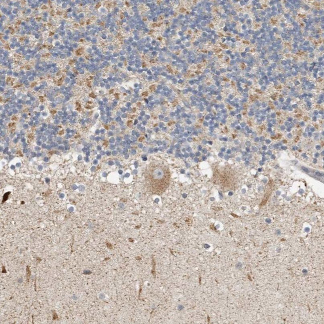 KIF26B Antibody in Immunohistochemistry (IHC)