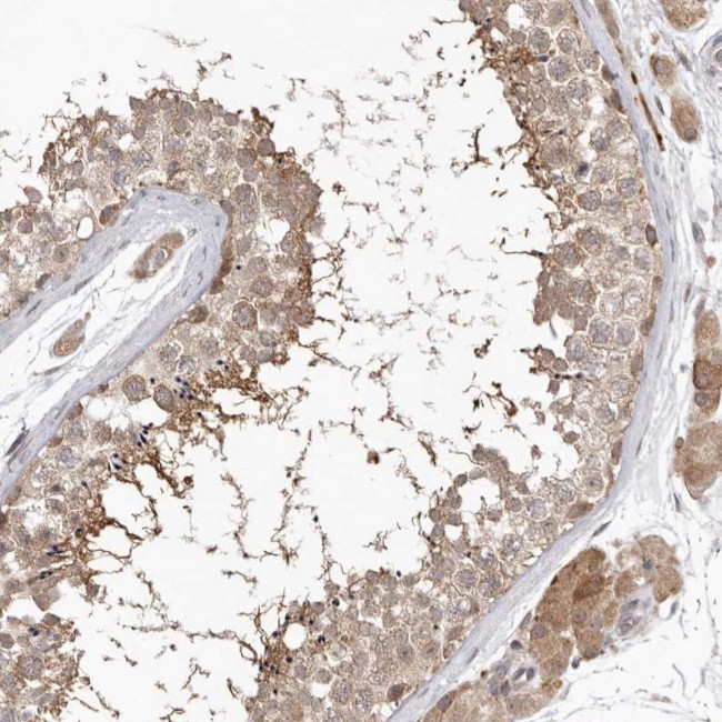 NSUN4 Antibody in Immunohistochemistry (IHC)