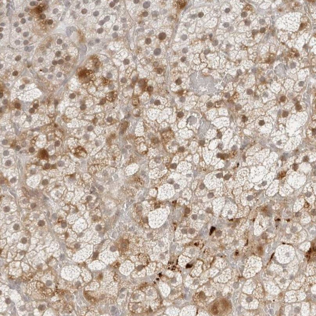 ZNF678 Antibody in Immunohistochemistry (IHC)