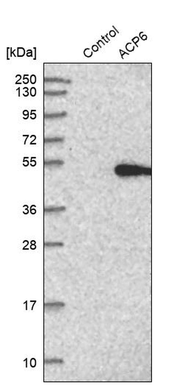 ACP6 Antibody in Western Blot (WB)