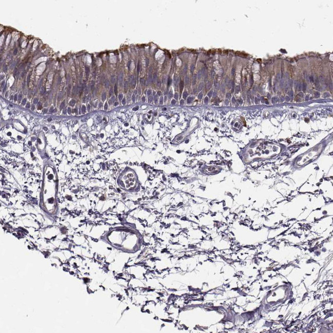 SPAG17 Antibody in Immunohistochemistry (IHC)