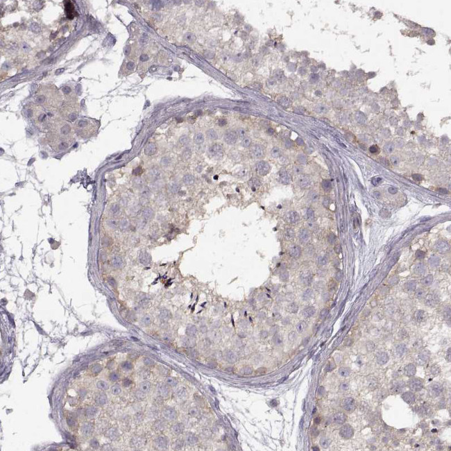 SPAG17 Antibody in Immunohistochemistry (IHC)