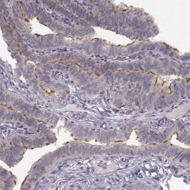 SPAG17 Antibody in Immunohistochemistry (IHC)