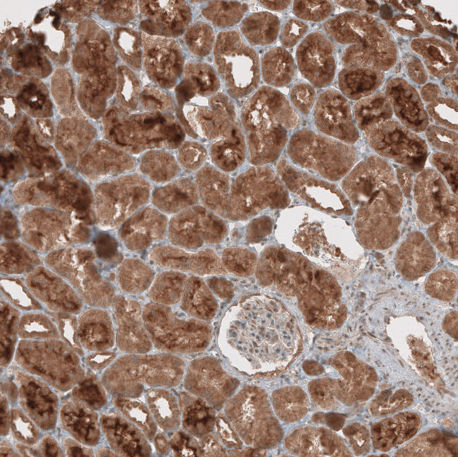 RAB11FIP3 Antibody in Immunohistochemistry (IHC)