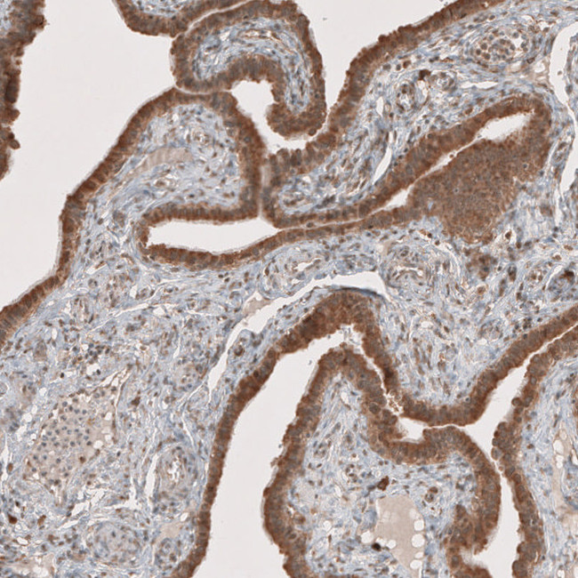 RAB11FIP3 Antibody in Immunohistochemistry (IHC)