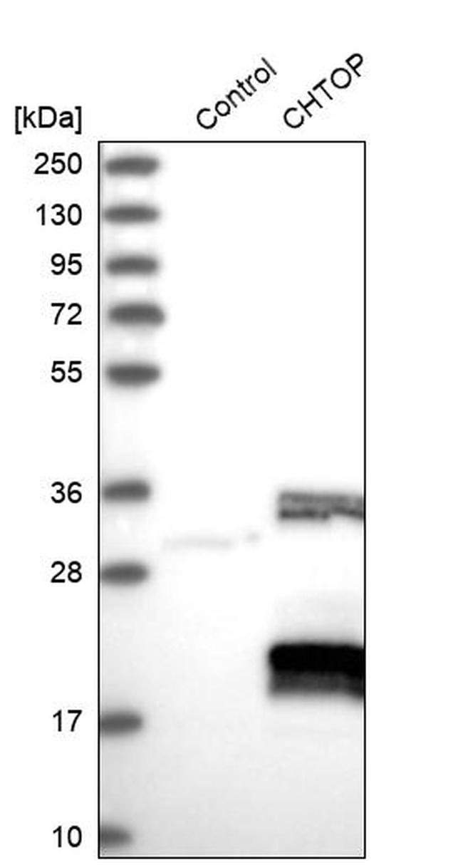 C1orf77 Antibody in Western Blot (WB)