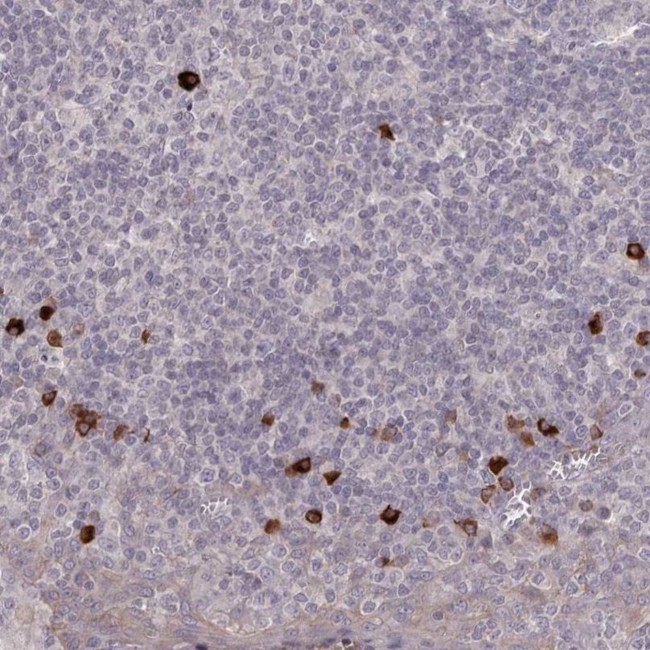 HCAR2 Antibody in Immunohistochemistry (IHC)