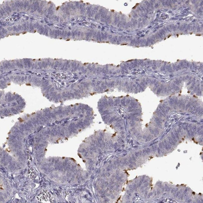 SPAG17 Antibody in Immunohistochemistry (IHC)