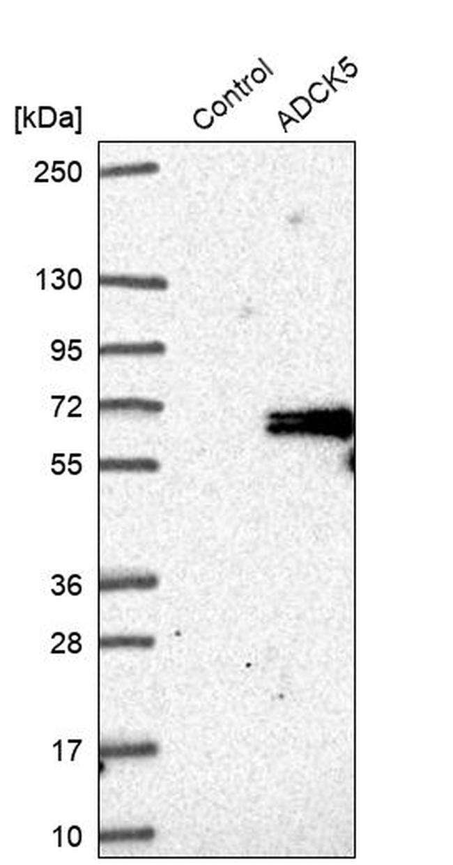 ADCK5 Antibody in Western Blot (WB)