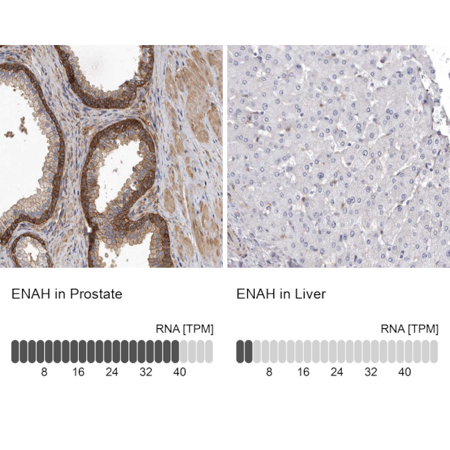 ENAH Antibody in Immunohistochemistry (IHC)