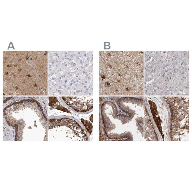 ENAH Antibody in Immunohistochemistry (IHC)