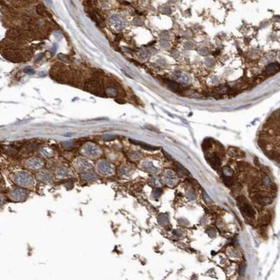 ENAH Antibody in Immunohistochemistry (IHC)