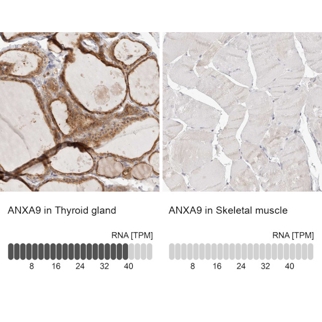 Annexin A9 Antibody in Immunohistochemistry (IHC)