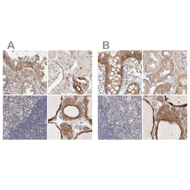 Annexin A9 Antibody in Immunohistochemistry (IHC)