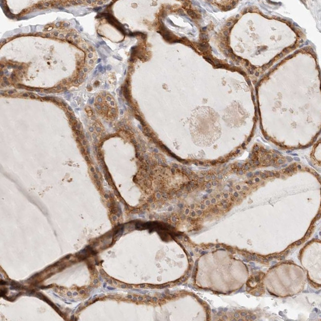 Annexin A9 Antibody in Immunohistochemistry (IHC)