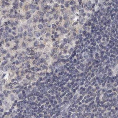 Annexin A9 Antibody in Immunohistochemistry (IHC)