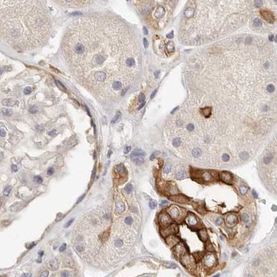 Annexin A9 Antibody in Immunohistochemistry (IHC)