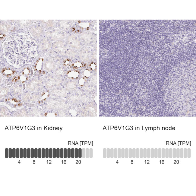 V-ATPase G3 Antibody in Immunohistochemistry (IHC)