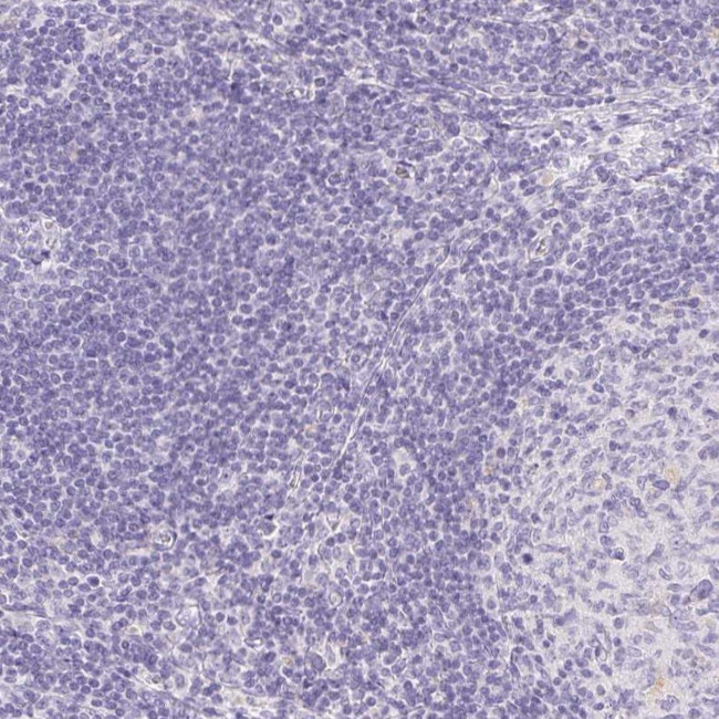 V-ATPase G3 Antibody in Immunohistochemistry (IHC)