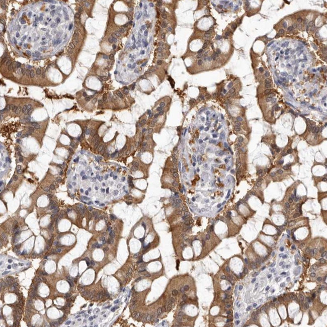 SULT1E1 Antibody in Immunohistochemistry (IHC)