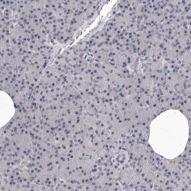 SULT1E1 Antibody in Immunohistochemistry (IHC)