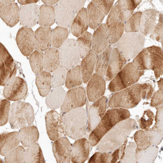 PPP1R3B Antibody in Immunohistochemistry (IHC)