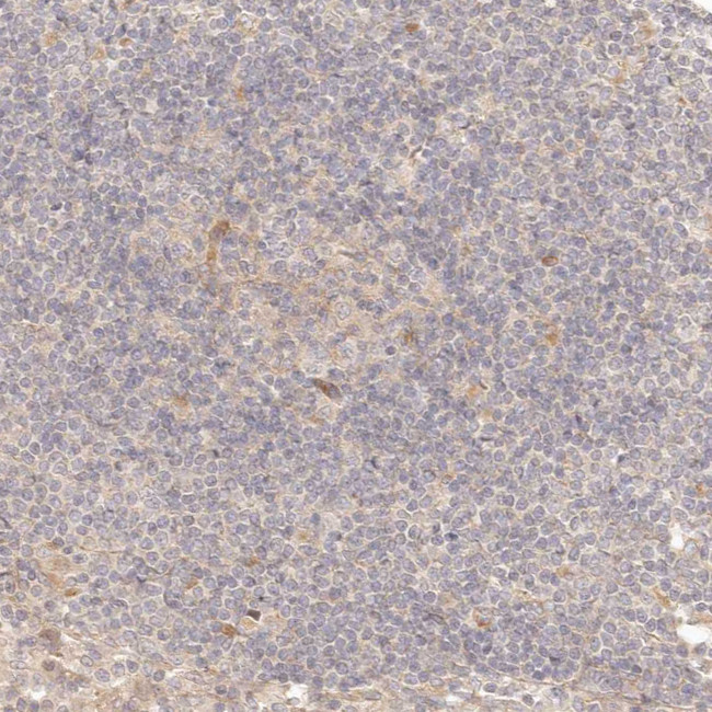 PPP1R3B Antibody in Immunohistochemistry (IHC)