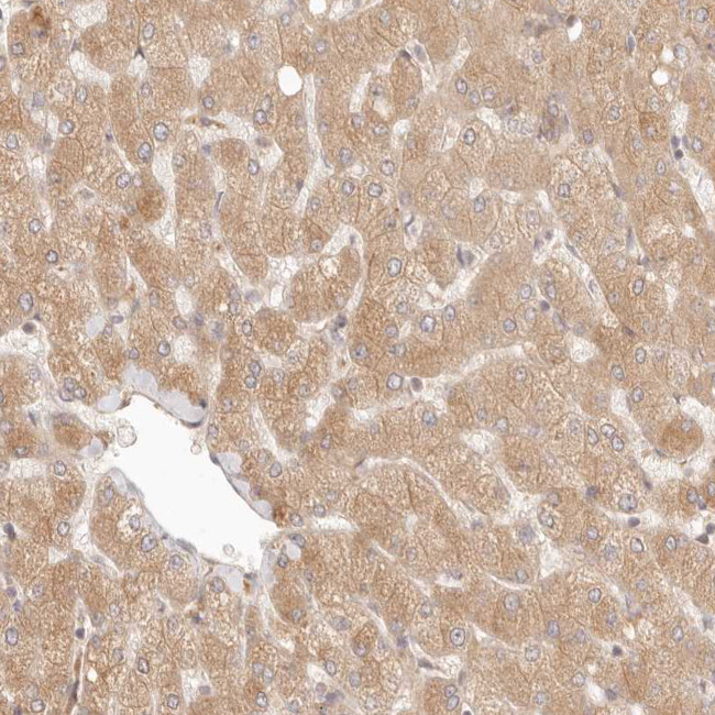 PPP1R3B Antibody in Immunohistochemistry (IHC)