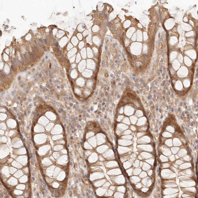 PPP1R3B Antibody in Immunohistochemistry (IHC)