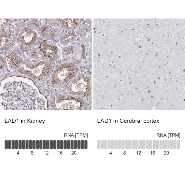 LAD1 Antibody in Immunohistochemistry (IHC)