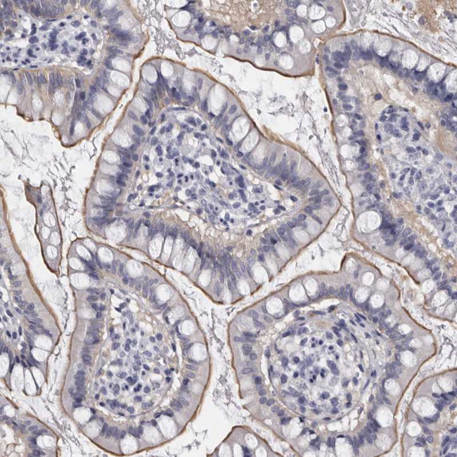 LAD1 Antibody in Immunohistochemistry (IHC)