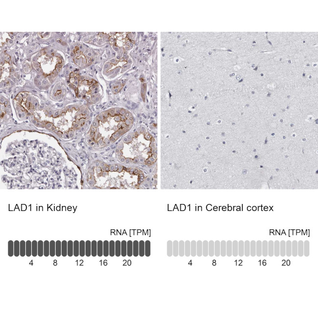 LAD1 Antibody