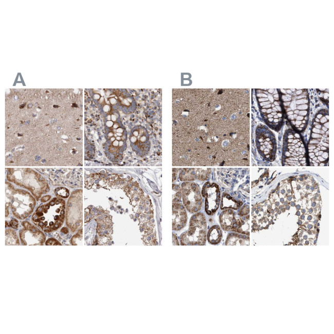 MECR Antibody in Immunohistochemistry (IHC)