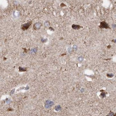 MECR Antibody in Immunohistochemistry (IHC)