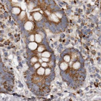 MECR Antibody in Immunohistochemistry (IHC)