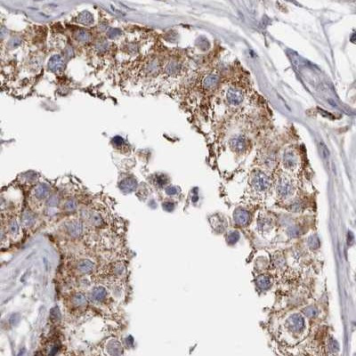 MECR Antibody in Immunohistochemistry (IHC)