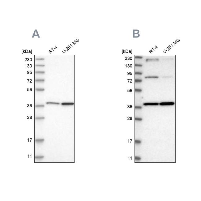 MECR Antibody in Western Blot (WB)