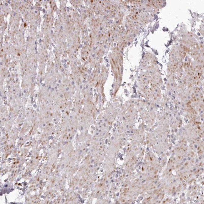 GARNL3 Antibody in Immunohistochemistry (IHC)