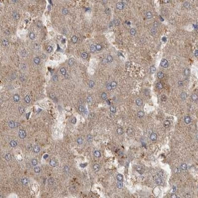 MRPL18 Antibody in Immunohistochemistry (IHC)