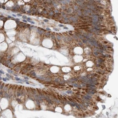 MRPL18 Antibody in Immunohistochemistry (IHC)