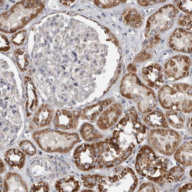 MRPL18 Antibody in Immunohistochemistry (IHC)