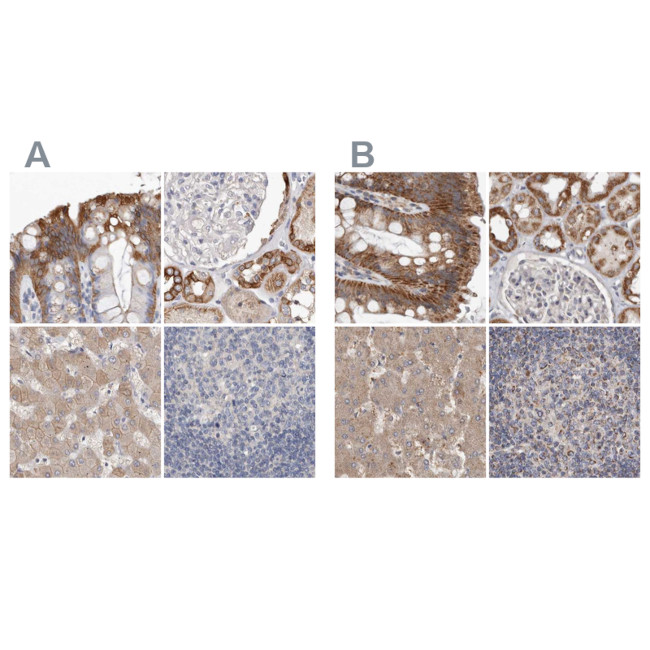 MRPL18 Antibody in Immunohistochemistry (IHC)