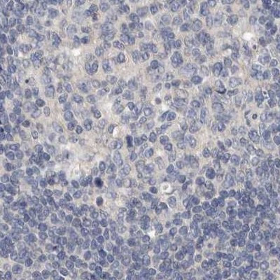 MRPL18 Antibody in Immunohistochemistry (IHC)