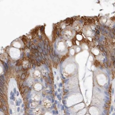 MRPL18 Antibody in Immunohistochemistry (IHC)