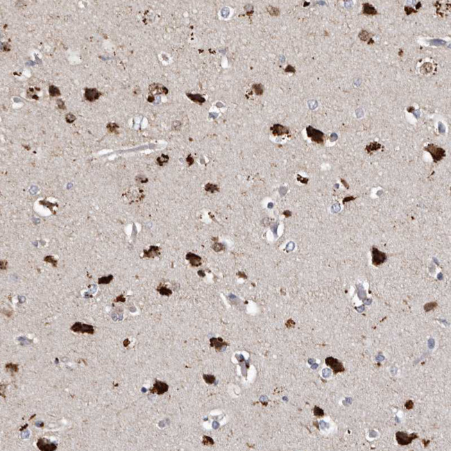 SLC10A4 Antibody in Immunohistochemistry (IHC)