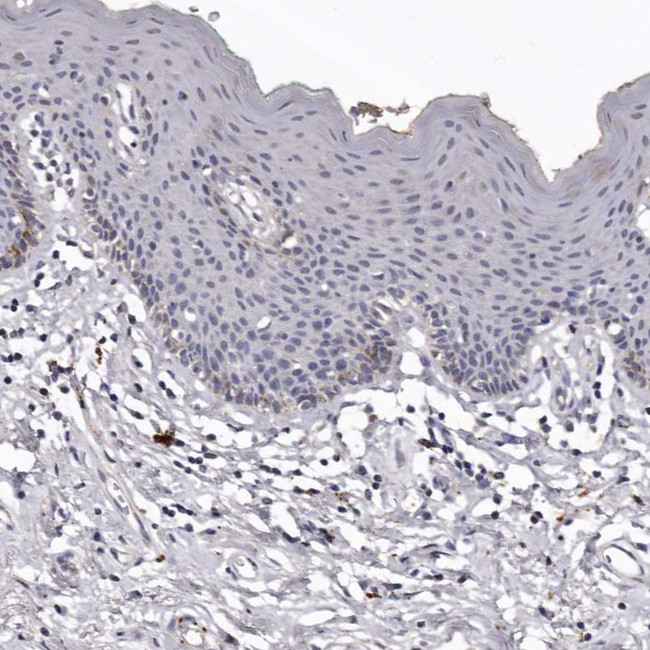 SLC10A4 Antibody in Immunohistochemistry (IHC)