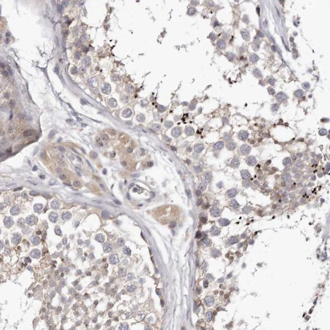 LMLN Antibody in Immunohistochemistry (IHC)